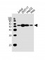 TUBB2A Antibody (C-term)