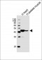 HFE2 Antibody (Center)