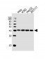 PCBP1 Antibody (Center)
