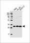 PEF1 Antibody (Center)
