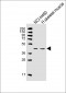 FEZ2 Antibody (N-term)