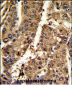 PSME2 Antibody (C-term)