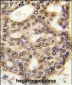 HDGF Antibody (C-term)