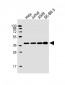 HDGF Antibody (C-term)