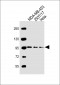 FBXO11 Antibody (N-term)