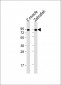 hsp90a.1 Antibody (Center)