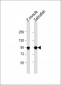 hsp90a.1 Antibody (Center)