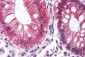 CTNNB1 / Beta Catenin Antibody (aa43-62)
