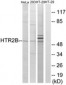 HTR2B / 5-HT2B Receptor Antibody (aa15-64)