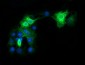 FCGR1A / CD64 Antibody (clone 3D3)