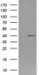 FCGR1A / CD64 Antibody (clone 3D3)