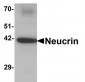 C1orf187 / DRAXIN Antibody (C-Terminus)