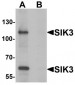 SIK3 / QSK Antibody (C-Terminus)