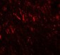 PRICKLE2 Antibody (Internal)
