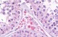 PRICKLE2 Antibody (Internal)