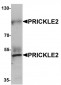 PRICKLE2 Antibody (Internal)