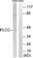 AGPAT3 Antibody (aa121-170)