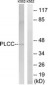 AGPAT3 Antibody (aa121-170)