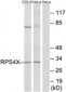 RPS4X / SCAR Antibody (aa81-130)