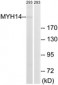 MYH14 Antibody (aa1051-1100)