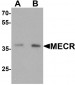 MECR Antibody (C-Terminus)