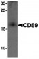 CD59 Antibody (N-Terminus)
