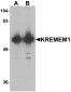 KREMEN1 / KREMEN-1 Antibody (C-Terminus)