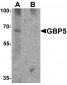 GBP5 Antibody (C-Terminus)
