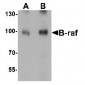 BRAF / B-Raf Antibody (Internal)