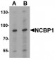 NCBP1 / CBP80 Antibody (Internal)