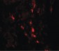 ARSB / Arylsulfatase B Antibody (C-Terminus)