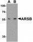 ARSB / Arylsulfatase B Antibody (C-Terminus)