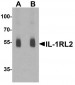 IL1RL2 Antibody (Internal)