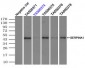 SERPINA1 / Alpha 1 Antitrypsin Antibody (clone 9A1)