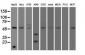 SERPINA1 / Alpha 1 Antitrypsin Antibody (clone 9A1)