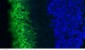 Rhodopsin / RHO Antibody (clone B630)