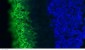 Rhodopsin / RHO Antibody (clone B630)