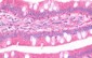 GBP5 Antibody