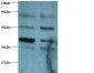 GDI2 Antibody