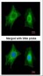 PSPH Antibody (aa1-175)