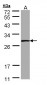 PSPH Antibody (aa1-175)