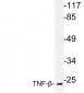 LTA / TNF Beta Antibody (aa31-80)