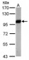 VCP Antibody (aa1-206)