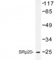 SRSF3 / SRP20 Antibody (aa120-170)