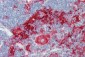GSN / Gelsolin Antibody (clone GEL-42)