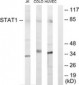 STAT1 Antibody (aa141-190)