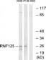 RNF125 Antibody (aa131-180)