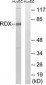 RDX / Radixin Antibody (aa142-191)