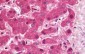 RAD23B / HR23B Antibody (aa27-76)