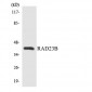 RAD23B / HR23B Antibody (aa27-76)